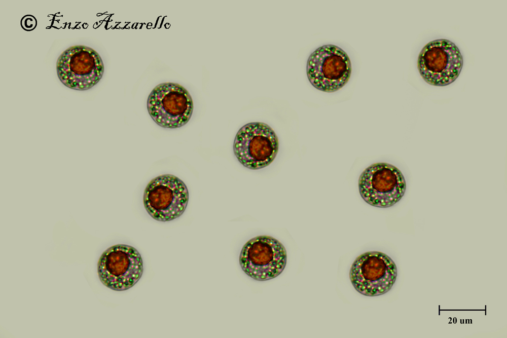 Haematococcus pluvialis stadio palmelloide o sbaglio?